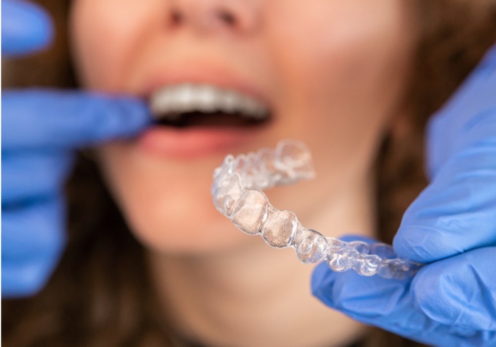 Invisalign invisible braces being attached to a patient at LakeStone Orthodontics