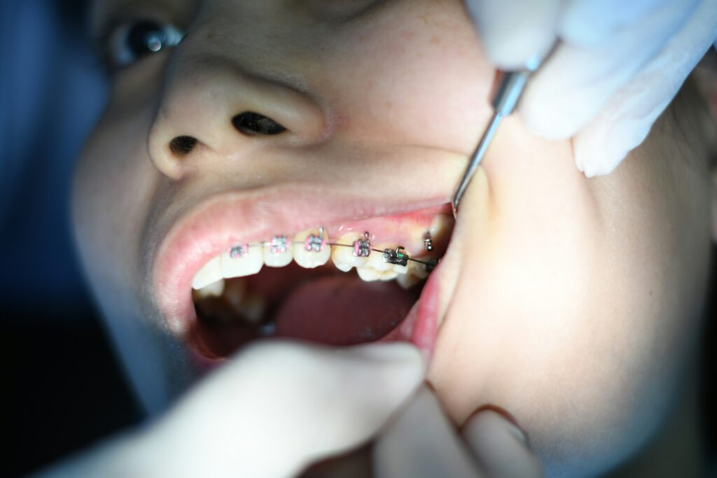 Child receiving family orthodontic care in getzville NY